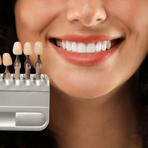 Dental Crown